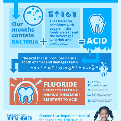 Smile Guyana Dental Services - Fluoride is a mineral naturally occurring in  bones & teeth that is also added to toothpastes. Dentists generally  recommend you brush with a fluoride-based toothpaste. Here is